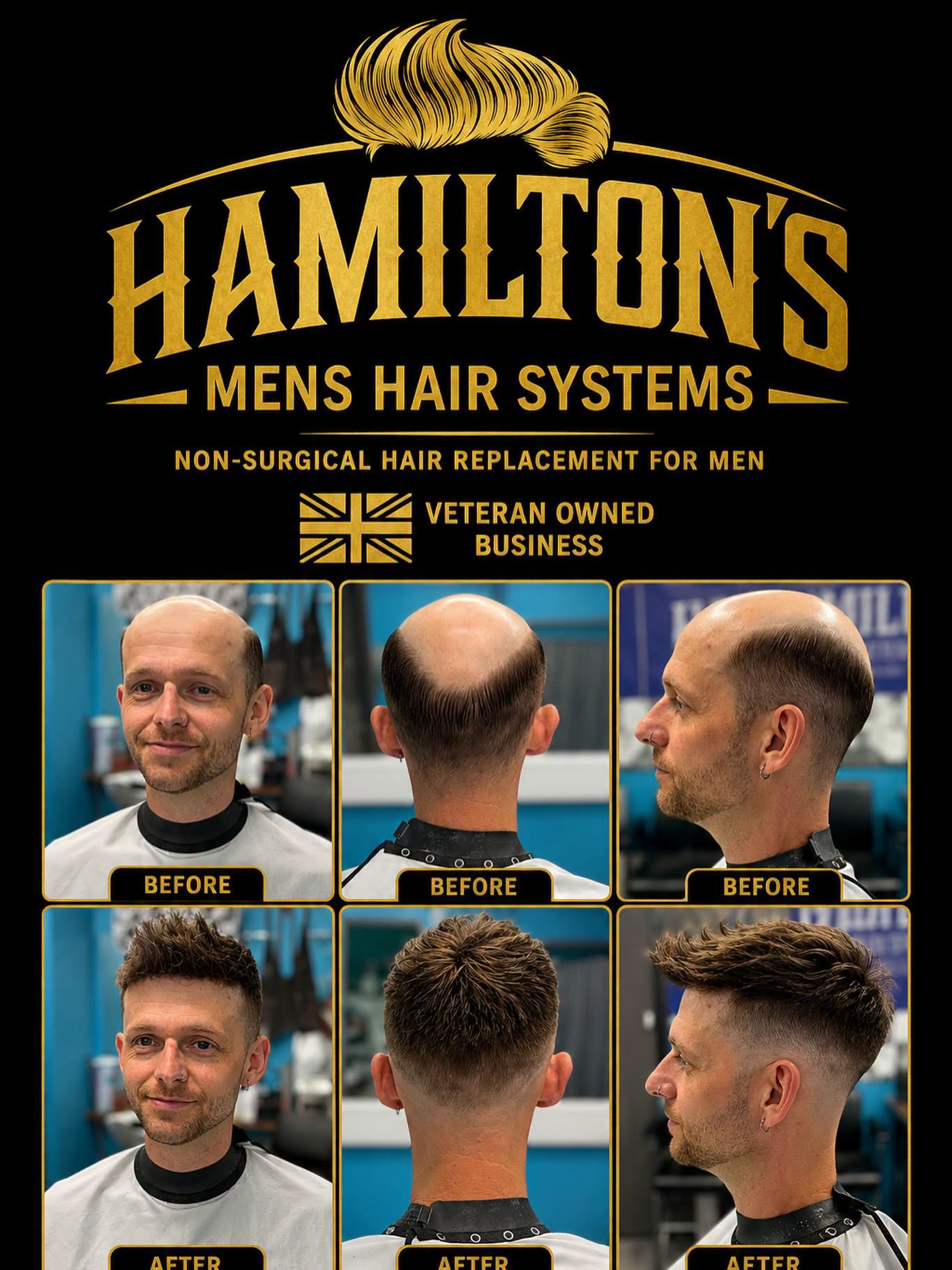 Hamilton's men's hair system before and after — front, back and profile