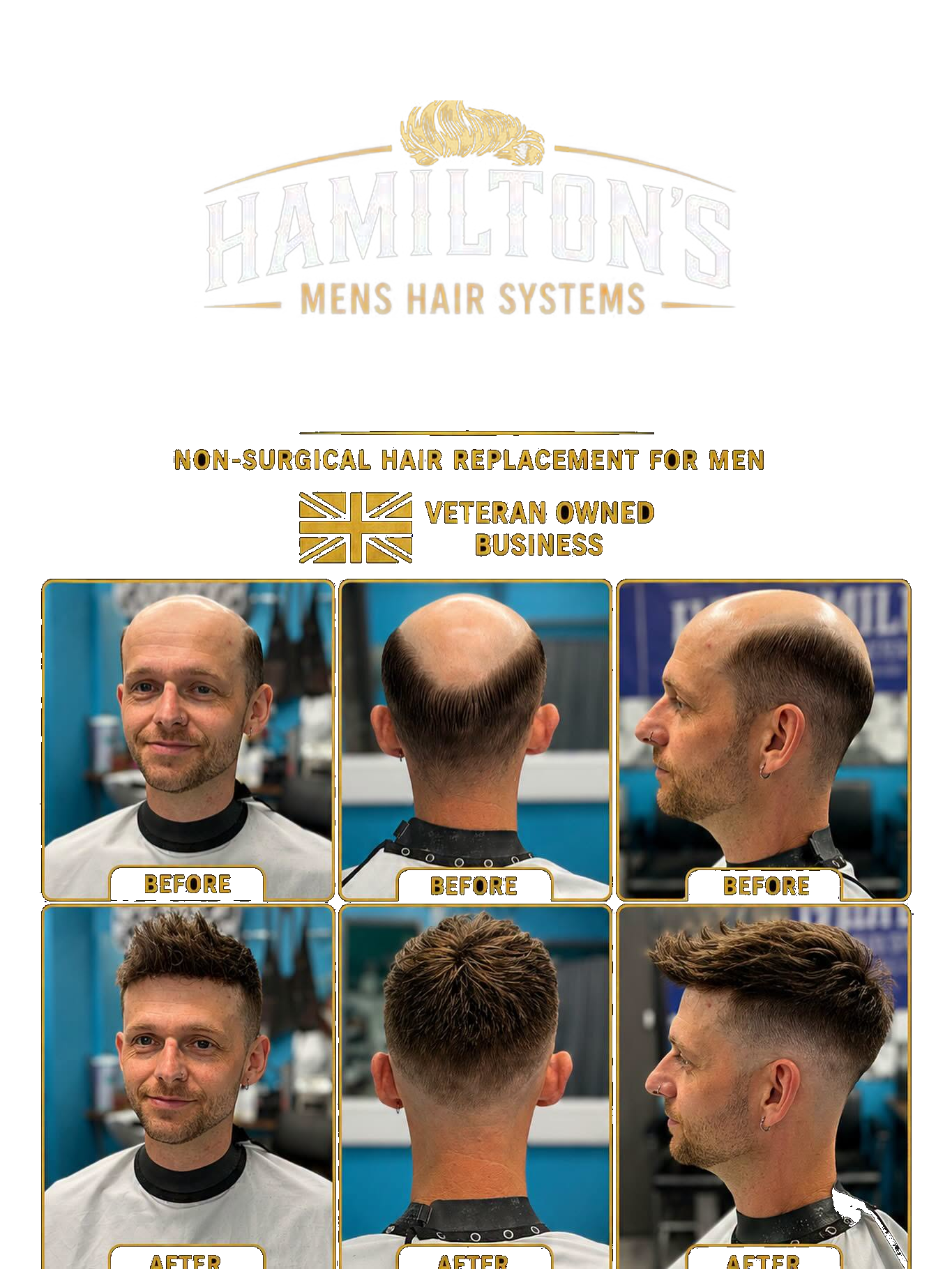 Hamilton's men's hair system before and after — front, back and profile
